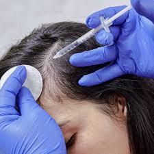 Hair GFC + Microneedling